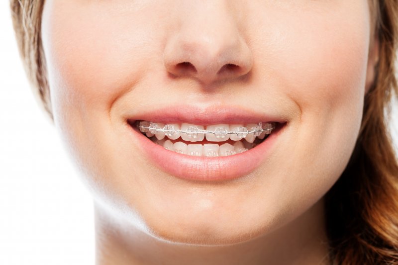 The Art of Braces – Orthodontics as an Art Form