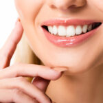 Porcelain Veneers