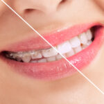 COSMETIC DENTISTRY